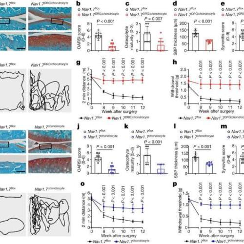 Epilepsy drug shows promise in slowing joint degeneration in osteoarthritis