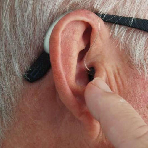 Sudden hearing loss study: High-dose therapy does not lead to better outcomes than the standard treatment