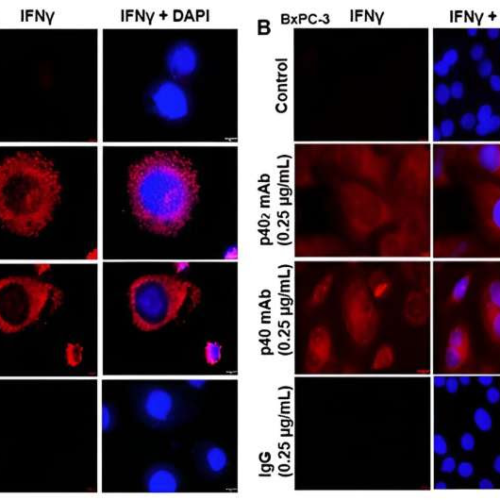 New potential immunotherapies for pancreatic cancer