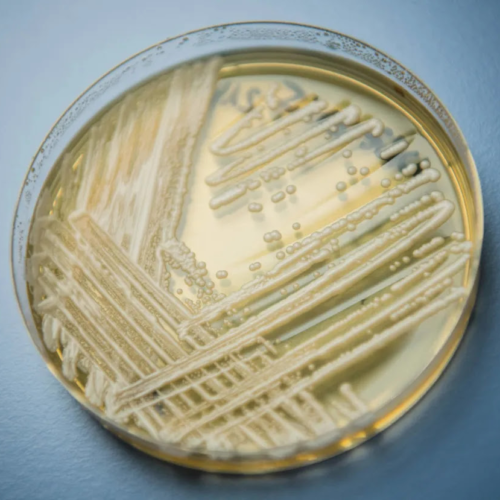 Washington faces first outbreak of a deadly fungal infection that’s on the rise in the U.S.