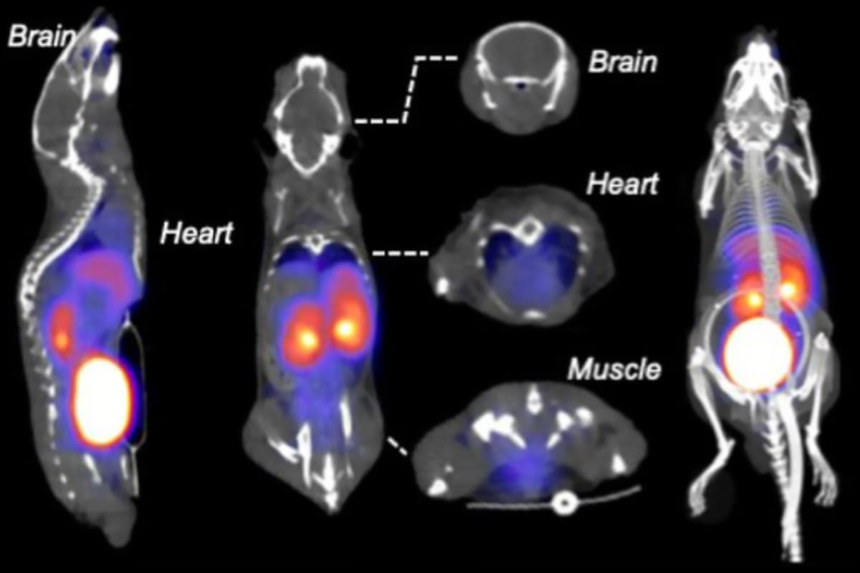 Radioactive ‘fruit sugar’ lights up cancer and inflammation