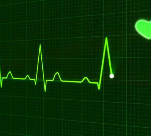 Spotlight on early detection of three heart diseases using ECG-AI