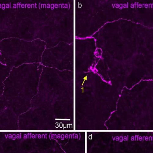 Research identifies nerve endings that shed light on gut-brain communication