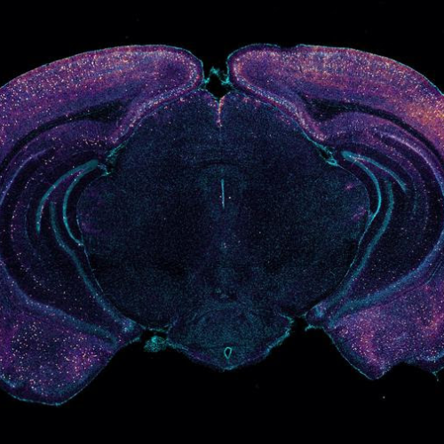 How 40Hz sensory gamma rhythm stimulation clears amyloid in Alzheimer’s mice