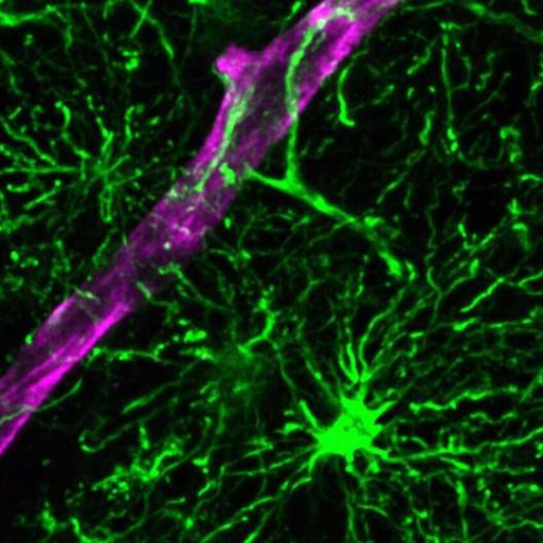 More than just neurons: Scientists create new model for studying human brain inflammation