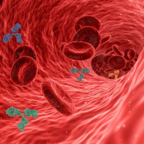 Study finds new treatment to reverse inflammation and arterial blockages in rheumatoid arthritis