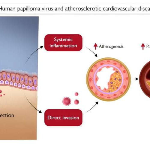 Women with HPV infection face higher risk of death from cardiovascular disease, finds study