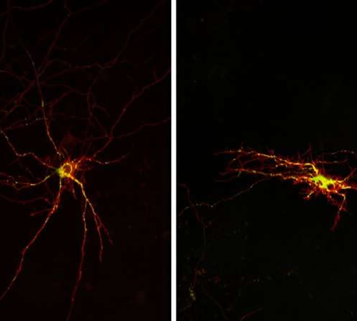 Researchers find a molecular mechanism related to neuronal death