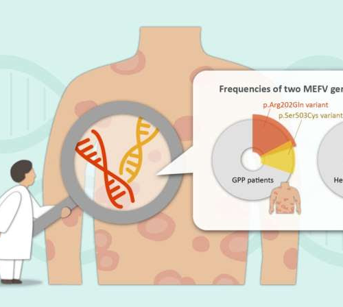 Missing disease-related gene identified in generalized pustular psoriasis