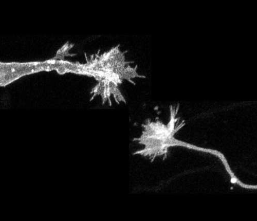 Growth cone in migrating neurons involved in promoting neuronal migration and regeneration in brain injury, study shows