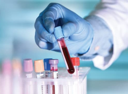 6 Important Blood Tests