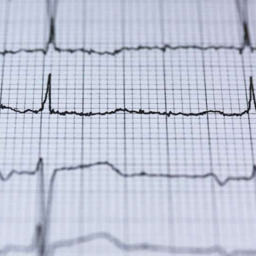 Understanding your heart test: What to expect, how to prepare