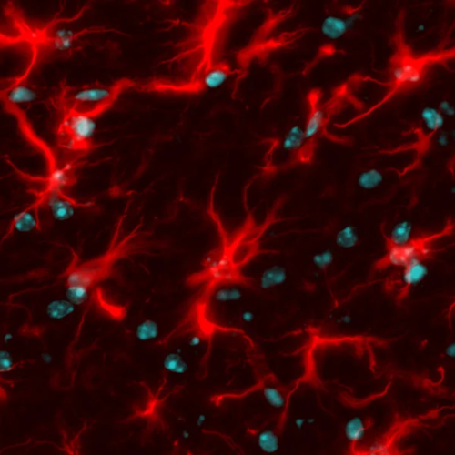 Fixing Rogue Brain Cells May Hold Key to Preventing Neurodegeneration