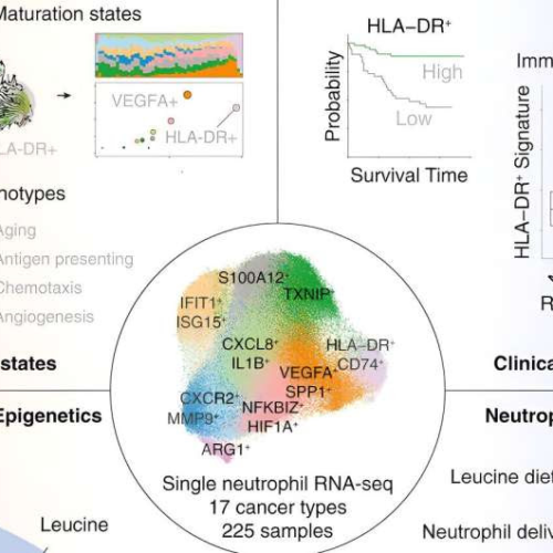 Scientists unravel tumor neutrophil complexity, discover therapeutic subset