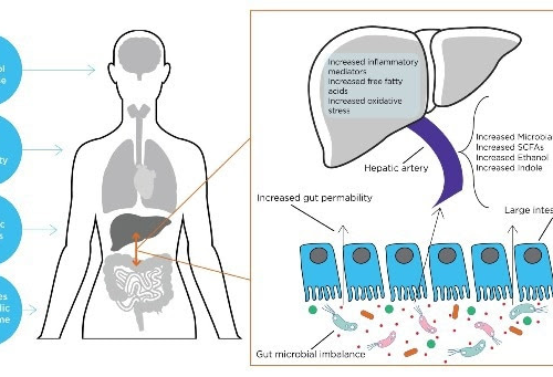 What are the links between liver disease and the microbiome?