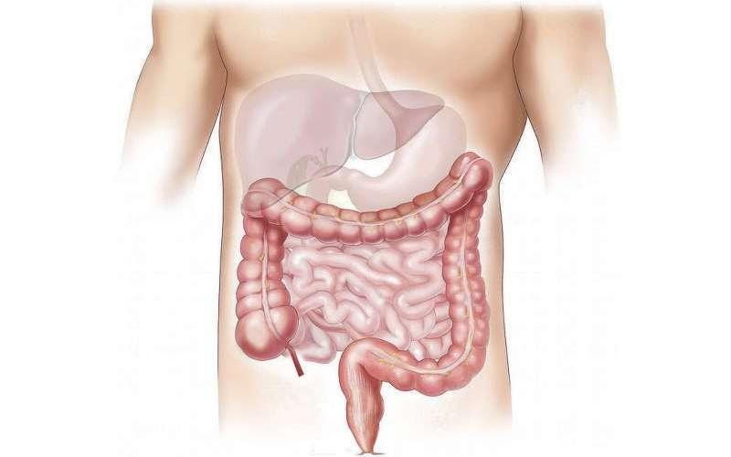 Gastroenterologist offers tips to make colonoscopy bowel prep easier