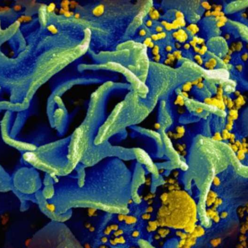Pharma firm urged to share new ‘game-changer’ HIV drug
