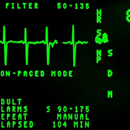 Modular communicative leadless ICD found to be safe and exceeds performance expectations