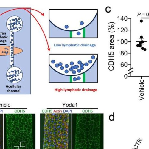 Researcher discovers drug that may delay onset of Alzheimer’s, Parkinson’s disease and treat hydrocephalus