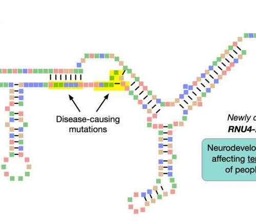 Researchers identify a genetic cause of intellectual disability affecting tens of thousands