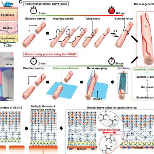 ‘Sticky and strain-gradient artificial epineurium’ can heal severed nerves in only one minute, study claims