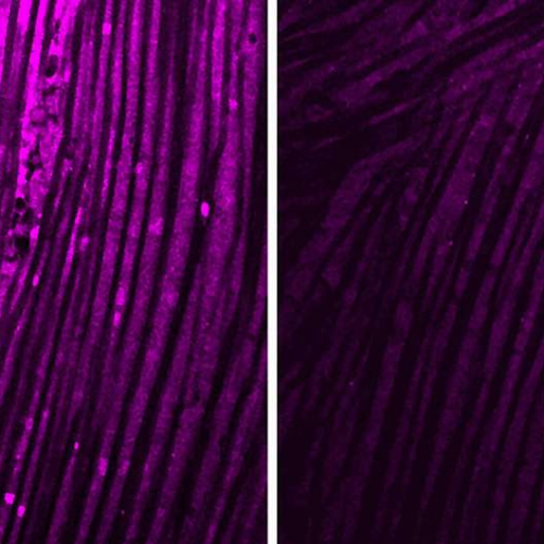 Scientists identify possible way to block muscle fatigue in long COVID, other diseases