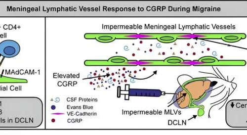 Migraine pain caused by lack of lymphatic system drainage in brain, study suggests