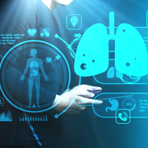 AI model accurately estimates pulmonary function from chest x-rays