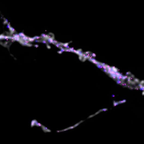 Molecular insights into cognitive impairment: New research uncovers how Parkinson’s affects the brain