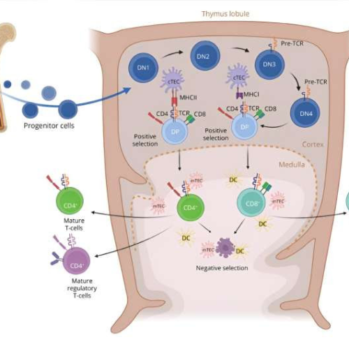 Benefits of thymectomy in treating myasthenia gravis