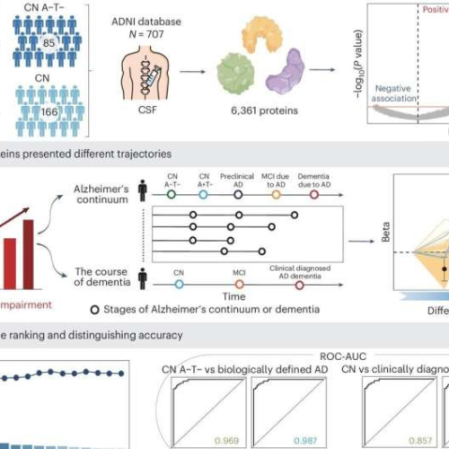 Study identifies new biomarkers of Alzheimer’s disease