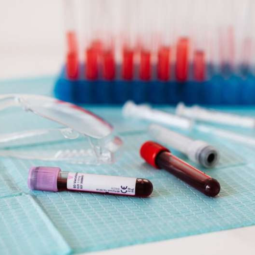 Prostate cancer blood test equally effective across ethnic groups