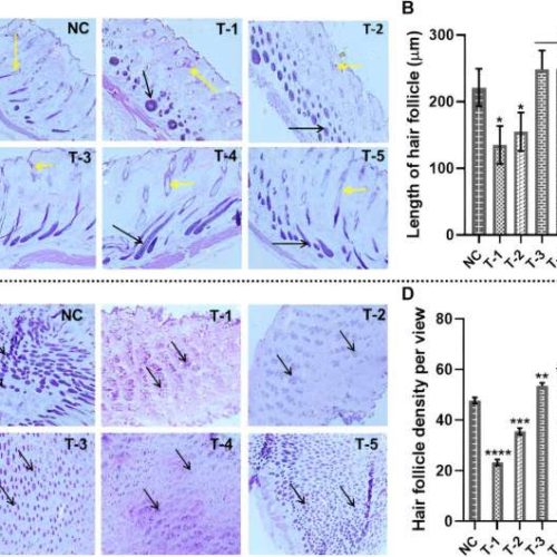 Cure for male pattern baldness given boost by sugar discovery