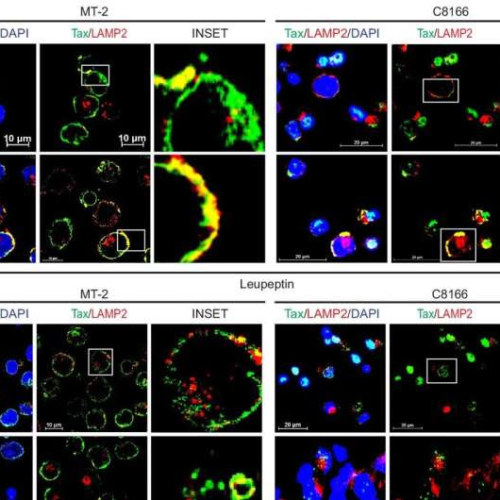 A new drug target identified for diseases associated with leukemia-causing virus