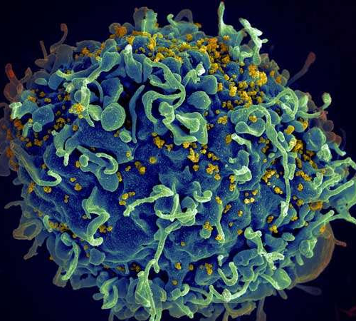 New ‘vaccine-like’ HIV drug could cost just $40: Researchers