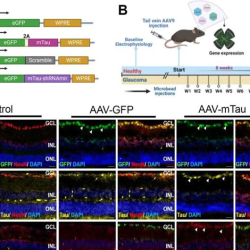 Gene therapy discovery triggers hope for glaucoma patients