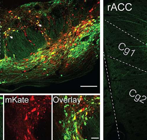 Neuroscientists discover brain circuitry of placebo effect for pain relief