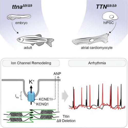 Tiny deletion in heart muscle protein linked to long-term effects on adult atrial fibrillation