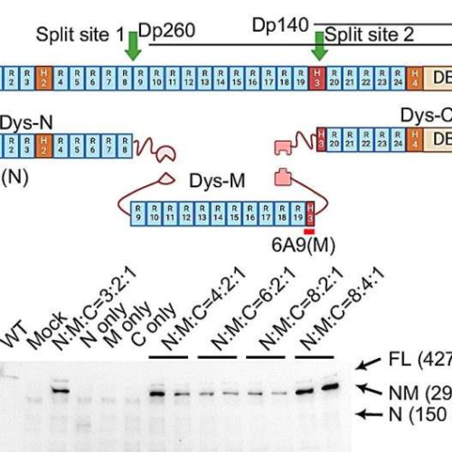 New gene therapy approach shows promise for Duchenne muscular dystrophy