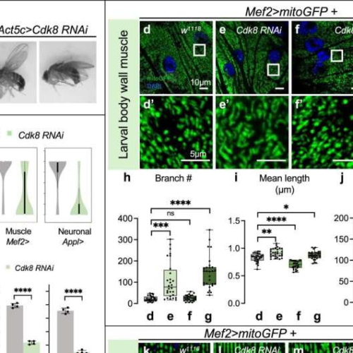 Fruit fly study identifies gene that may reverse Parkinson’s disease