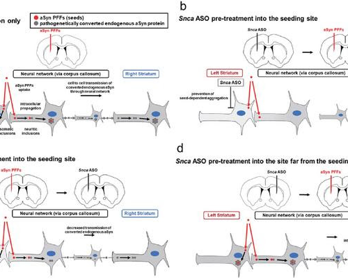 Antisense oligonucleotide treatment shows promise in treating Parkinson’s disease progression