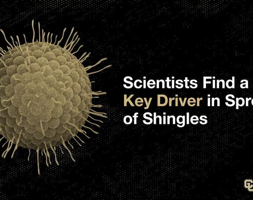 CU Anschutz scientists identify key protein behind spread of shingles virus