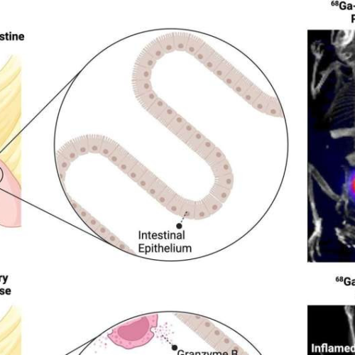 Novel PET imaging tool identifies early signs of inflammatory bowel disease and predicts response to treatment