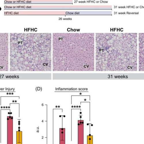 New research in fatty liver disease aims to help with early intervention