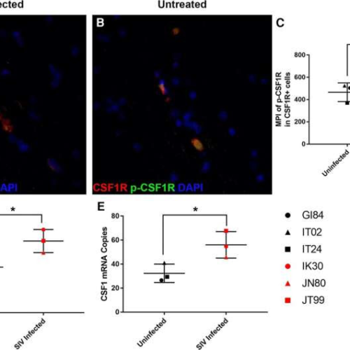 Experimental drug shows promise in clearing HIV from brain