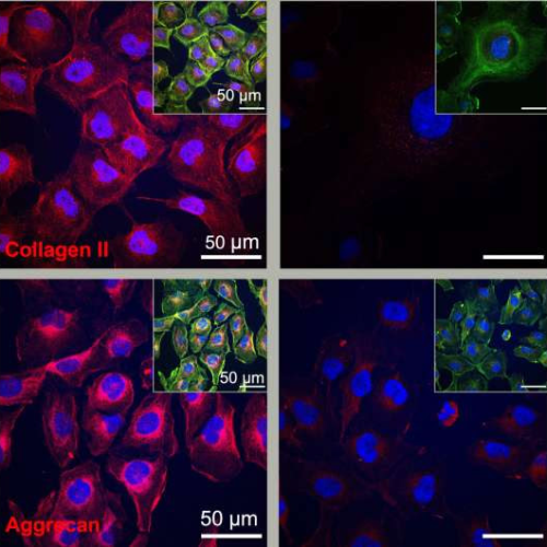 New study shows ‘dancing molecules’ can regenerate cartilage in 3 days