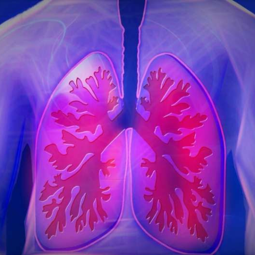 Improving health care for veterans with deployment-related lung diseases