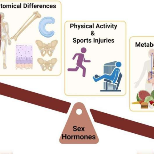 Females’ osteoarthritis risk should be addressed early in life, says study