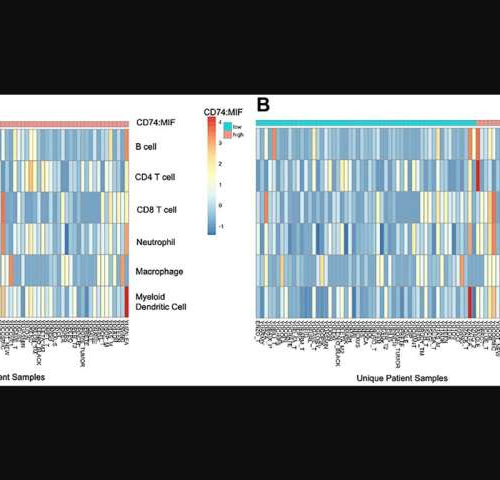 Prognostic and therapeutic insights into MIF, DDT, and CD74 in melanoma