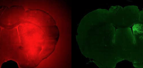 Researchers pioneer noninvasive measurement of gene expression at target locations in the brain